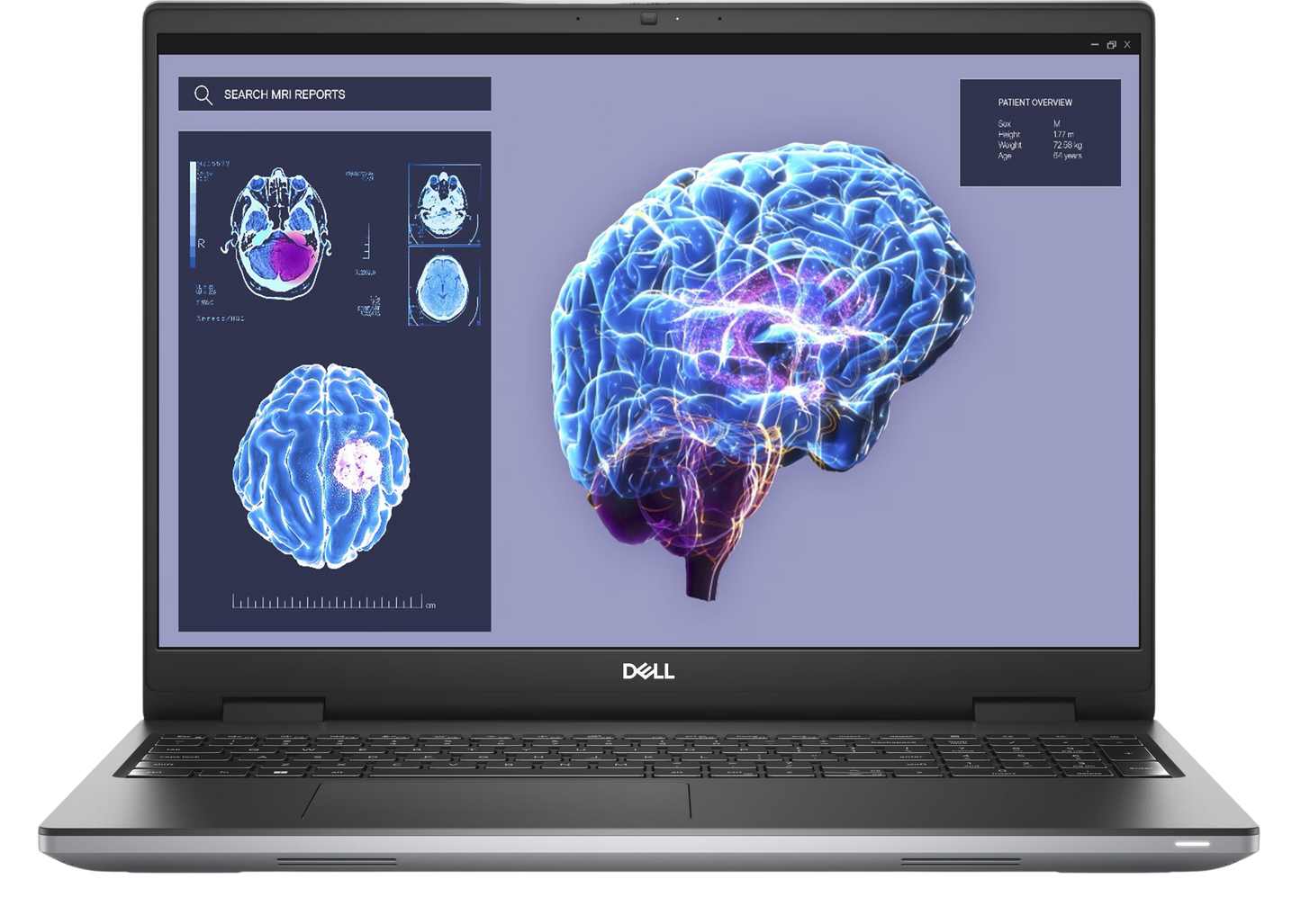 Dell Precision 7680 Workstation | Core i9-13950HX | 64GB | 1TB | RTX 3500 |